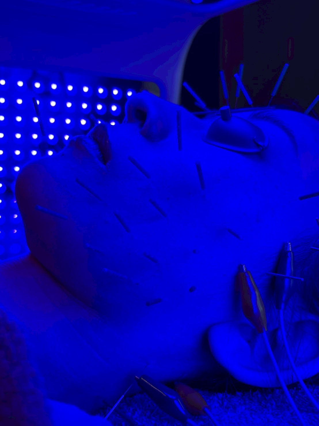 肌質特化 × LED美容鍼 2